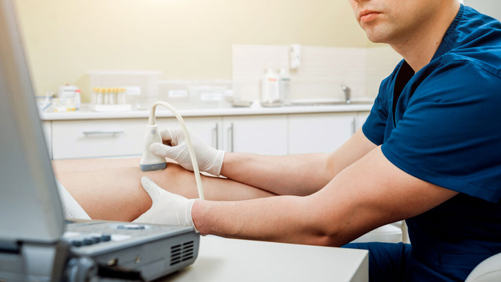 What a Leg Ultrasound can Reveal about Varicose Veins